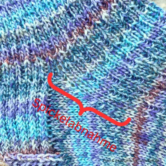 Spickelabnahme bei Sockentricken  Abbildung mit Markierung